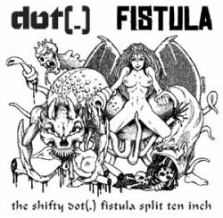 Dot(.) : Dot(.) - Fistula
